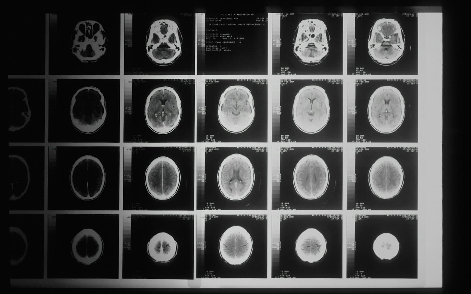 Medical scan images displayed on a light box